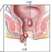 zhichuang1.gif