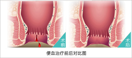 福州肛肠医院