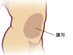 腹泻怎么有效的治疗？