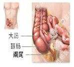 急性肠炎有哪些症状？