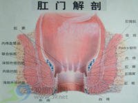 内痔危害：内痔不治会怎样