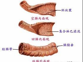 图示：慢性结肠炎